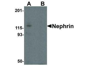 PAB Rabbit NEPHRIN Human IgG 100 µg ELISA