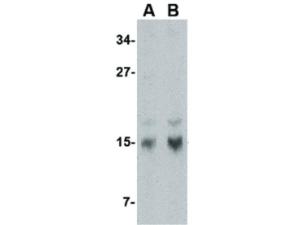 PAB Rabbit OP18 Human IgG N-term 100 µg