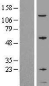 GNG5 Overexpression Lysate (Adult Normal), Novus Biologicals (NBL1-11176)
