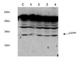 Anti-Cyclin Dependent Kinase Rabbit Polyclonal Antibody