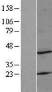 MRPS22 Overexpression Lysate (Adult Normal), Novus Biologicals (NBL1-13293)