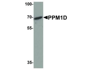 PAB Rabbit PPM1D Human IgG C-term 100 µg