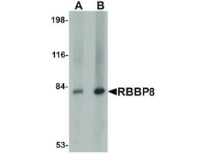 PAB Rabbit RBBP8 Human IgG N-term 100 µg