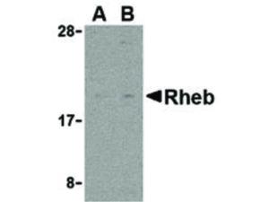 PAB Rabbit RHEB Human IgG N-term 100 µg