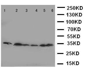 Anti-CDK4 Rabbit Polyclonal Antibody