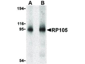 PAB Rabbit RP105 Human IgG 100 µg ELISA