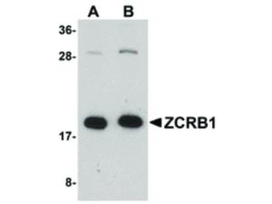 PAB Rabbit ZCRB1 Human IgG 100 µg ELISA
