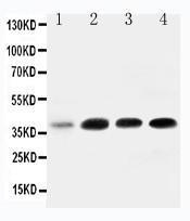 Anti-IGFBP3 Rabbit Polyclonal Antibody