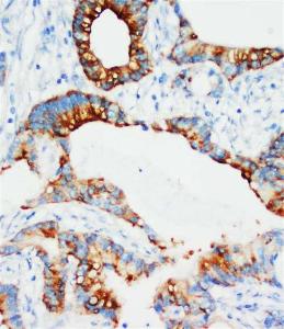 Anti-IGFBP3 Rabbit Polyclonal Antibody