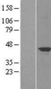 Tau Overexpression Lysate (Adult Normal)-Western Blot