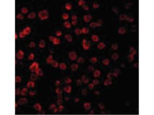 PAB Rabbit TLR11 Human IgG 100 µg ELISA