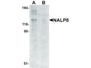 PAB Rabbit NALP8 Human IgG 100 µg ELISA