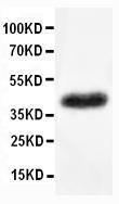 Anti-CD147 Rabbit Polyclonal Antibody