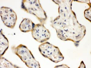 DDAH2 was detected in paraffin-embedded sections of human placenta tissues using rabbit anti- DDAH2 Antigen Affinity purified polyclonal antibody (Catalog # PB10001) at 1 ?g/ml. The immunohistochemical section was developed using SABC method (Catalog # SA1022).