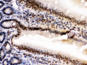 HMGB2 was detected in paraffin-embedded sections of mouse intestine tissues using rabbit anti- HMGB2 Antigen Affinity purified polyclonal antibody (Catalog # PB10002) at 1 ?g/ml. The immunohistochemical section was developed using SABC method (Catalog # SA1022).