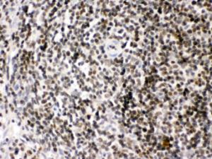 HMGB2 was detected in paraffin-embedded sections of rat spleen tissues using rabbit anti- HMGB2 Antigen Affinity purified polyclonal antibody (Catalog # PB10002) at 1 ?g/ml. The immunohistochemical section was developed using SABC method (Catalog # SA1022).