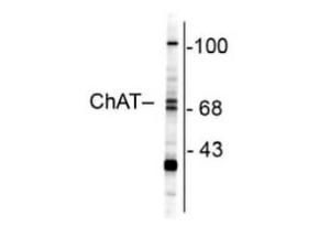 CHAT (Choline acetyl transfer AS)