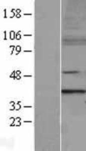 MTERF Overexpression Lysate (Adult Normal), Novus Biologicals (NBL1-13356)