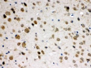ABR was detected in paraffin-embedded sections of mouse brain tissues using rabbit anti- ABR Antigen Affinity purified polyclonal antibody (Catalog # PB9972) at 1 ?g/ml. The immunohistochemical section was developed using SABC method (Catalog # SA1022).