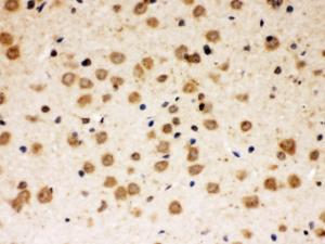ABR was detected in paraffin-embedded sections of rat brain tissues using rabbit anti- ABR Antigen Affinity purified polyclonal antibody (Catalog # PB9972) at 1 ?g/ml. The immunohistochemical section was developed using SABC method (Catalog # SA1022).