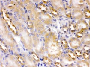 Alpha Actinin 4 was detected in paraffin-embedded sections of mouse kidney tissues using rabbit anti- Alpha Actinin 4 Antigen Affinity purified polyclonal antibody (Catalog # PB9974) at 1 ?g/ml. The immunohistochemical section was developed using SABC method (Catalog # SA1022).