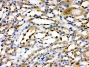 Alpha Actinin 4 was detected in paraffin-embedded sections of rat kidney tissues using rabbit anti- Alpha Actinin 4 Antigen Affinity purified polyclonal antibody (Catalog # PB9974) at 1 ?g/ml. The immunohistochemical section was developed using SABC method (Catalog # SA1022).