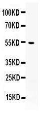 Western blot analysis of AEBP2 expression in HL-60 whole cell lysates (lane 1). AEBP2 at 70KD was detected using rabbit anti- AEBP2 Antigen Affinity purified polyclonal antibody (Catalog # PB9977) at 0.5 ?g/ml. The blot was developed using chemiluminescence (ECL) method (Catalog # EK1002).