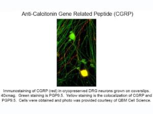 Calcitonin gene related peptide
