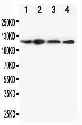 Anti-CIAS1/NALP3 Rabbit Polyclonal Antibody