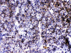 BCA1 was detected in paraffin-embedded sections of mouse lymphaden tissues using rabbit anti- BCA1 Antigen Affinity purified polyclonal antibody (Catalog # PB9999) at 1 ?g/ml. The immunohistochemical section was developed using SABC method (Catalog # SA1022).