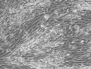 CELLvo™ Human Adipose Derived-Mesenchymal Stem Cells (hAD-MSC)