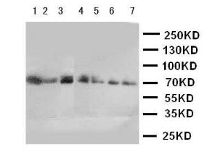 Anti-CYP11B1 Rabbit Polyclonal Antibody
