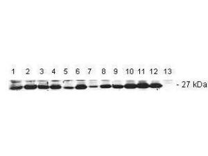 RB Anti-BCL 2 Human 200 µg