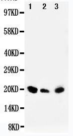 Anti-DUSP3 Rabbit Polyclonal Antibody