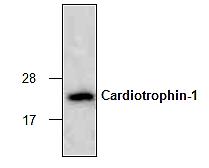 The purity of recombinant human Cardiotrophin-1 (2 µg) was analyzed by SDS-PAGE.