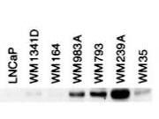 BIN1 antibody 25 µl
