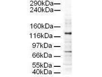 Antibody(Goat) AP3D1 100 µg