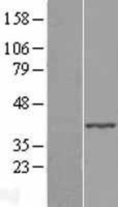 ABHD4 Overexpression Lysate (Adult Normal), Novus Biologicals (NBL1-07198)