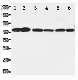 Anti-B Raf Rabbit Polyclonal Antibody