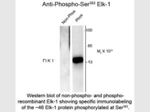ELK-1 phospho S383 antibody 10