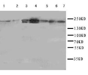Anti-DCC Rabbit Polyclonal Antibody