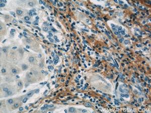Anti-Fibromodulin Mouse Monoclonal Antibody [clone: 3E9D10]