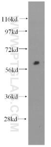 Anti-Fibromodulin Mouse Monoclonal Antibody [clone: 3E9D10]