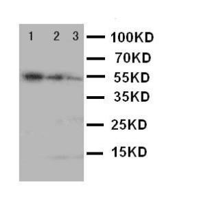 Anti-KI67 Rabbit Polyclonal Antibody