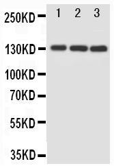 Anti-MAP3K1 Rabbit Polyclonal Antibody