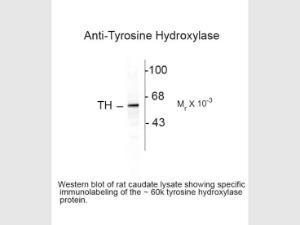 Tyrosine hydroxy antibody 100U