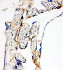Anti-MTTF1 Rabbit Polyclonal Antibody
