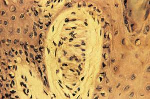 Meissner’s Corpuscle, (Primate)