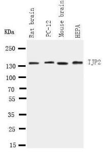 Anti-TJP2 Rabbit Polyclonal Antibody