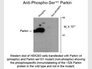 Parkin phospho S101 antibody 1